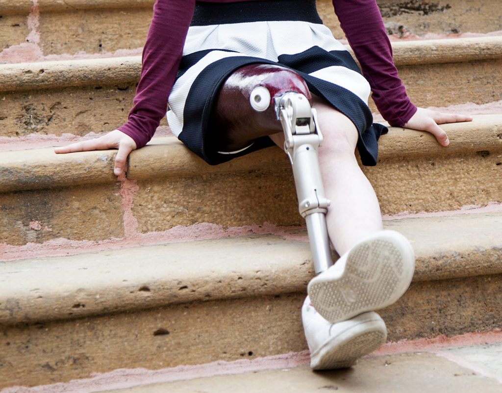 DİZ ÜSTÜ PROTEZLER BURSA