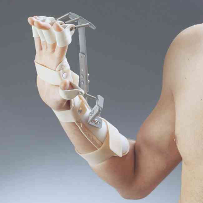 Üst Ekstremite Ortezler