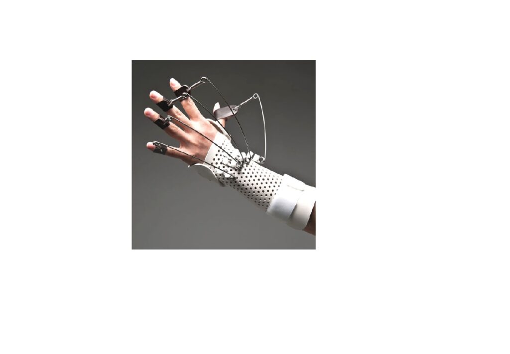 Ekstansör Tendon Kesisi Splinti BURSA