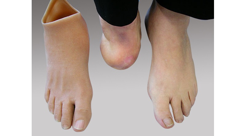 SİLİKON AYAK PROTEZLERİ